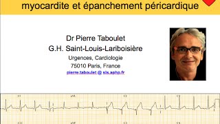 9a Péricardite Myocardite Épanchement péricardique ECG Dr Taboulet [upl. by Lanahtan]