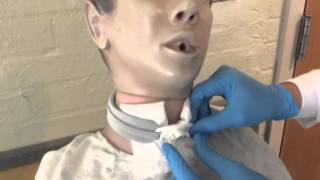 Trach Inner Cannula [upl. by Ahsemik356]