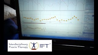 Was ist das Herzratenvariabilitätstraining HRVTraining [upl. by Cohla327]