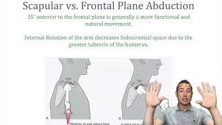 Shoulder Impingement Syndrome  ChiroUp [upl. by Johansen]