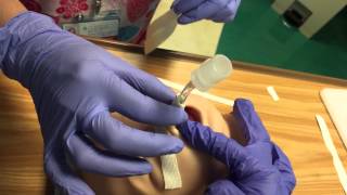 Endotracheal Tube Securing Technique Part 2 [upl. by Rollins]