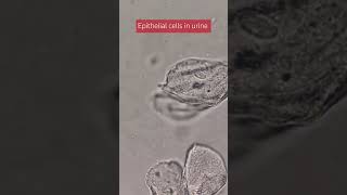 epithelial cells in urine [upl. by Mag924]