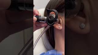 How To Safely Remove Ear Wax At Home 1003 [upl. by Wertheimer]