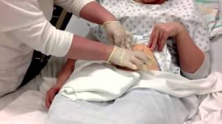 Colostomy Care Teaching Video [upl. by Lizabeth]