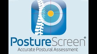 Advanced 4 View  Posture Assessment with PostureScreen [upl. by Glialentn]