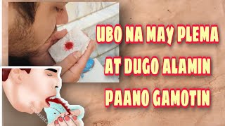 Ubo na may plema at dugo paano gamotin  how to cure bloody phlegm  bloody sputum [upl. by Naziaf]