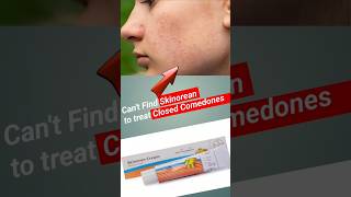 Solution for your closed comedones and mild acne pakistaniskincare indianskincare koreanskincare [upl. by Uird]