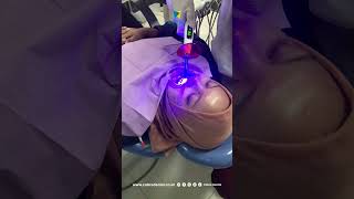 Laser LX 16 Plus Woodpecker dapat digunakan untuk tindakan bleaching gigi [upl. by Attiuqehs553]