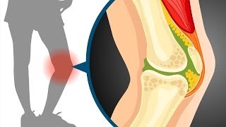 Sliding filament theory in muscle contraction  Wellcome [upl. by Crompton640]