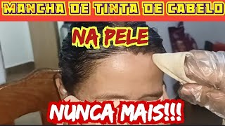 Como tirar TINTA DE CABELO da Pele com ingrediente da cozinha [upl. by Bricker924]