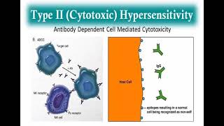 10 Hypersensitivity reactions Type 2  3 and 4 Hypersensitivity reactions شرح بالعربي [upl. by Essilevi383]