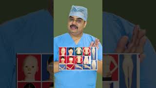 Options for keloid treatment  Dr Ashutosh Shah  Elegance Clinic  Surat keloid eleganceclinic [upl. by Irep]