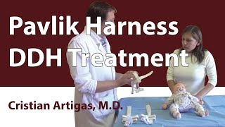 Pavlik Harness DDH Treatment [upl. by Gide]