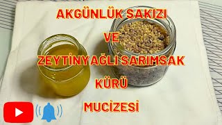 GÜNLÜK SAKIZI VE ZEYTİNYAĞLI SARIMSAK KÜRÜ MUCİZESİ 💯 [upl. by Epifano]