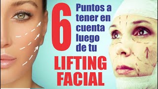 6 Recomendaciones POST LIFTING FACIAL 🧡 REJUVENECIMIENTO de ROSTRO👸 Dr Percy Nevado CIRUGÍA PLASTICA [upl. by Annoeik]