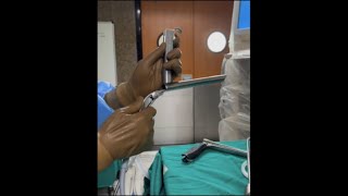 MLS microlaryngoscopy procedure [upl. by Semmes]