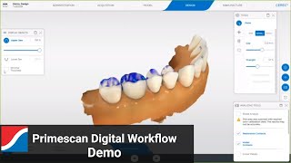 Primescan Digital Workflow and Software Demo [upl. by Atnuahs]