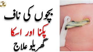 Bachon Ki Naaf Ka Ilaj l Naaf ka Pakna l Newborn Baby Care Tips In Urdu [upl. by Renelle]