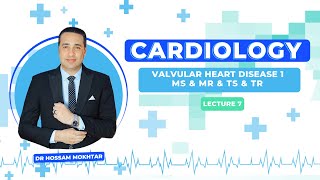 Cardiology  Valvular Heart Disease 1  MS amp MR amp TS amp TR [upl. by Anialad925]