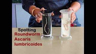 How to do SPOTTING  Biology Practical Class 12  Roundworm  Ascaris lumbricoides [upl. by Elicec943]