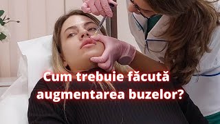 Cum trebuie realizata augmentarea buzelor  DermaBeauty Clinique [upl. by Ramej734]