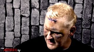 Heidenreich on his Facial Injuries [upl. by Naujet291]