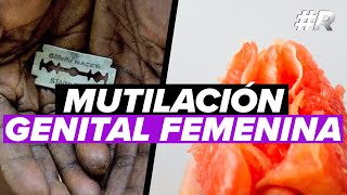 Mutilación Genital Femenina Tolerancia cero a las MGF  Ablación femenina significado [upl. by Arval]