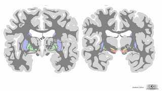 O que são os núcleos da base Qual a função dos núcleos da base Neuroanatomia Funcional Básica [upl. by Leilamag]