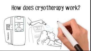 What is Cryotherapy  Cryotherapy Whiteboard Video [upl. by Eelhsa]