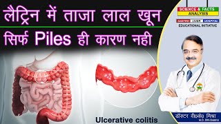 लैट्रीन में ताजा लाल खून सिर्फ Piles ही कारण नहीं  WHAT DISEASE CONDITIONS CAUSE BLOOD IN STOOL [upl. by Sualk]