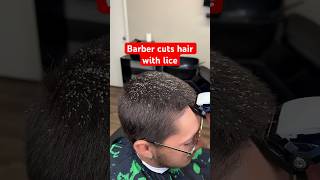 This man has lice 😱🤢🤮 barber haircut shorts [upl. by Dodi]