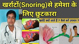 खर्राटे ।। Snoring । best homeopathic medicine for Snoring।। Snoring ka Homeopathic Treatment [upl. by Timms365]