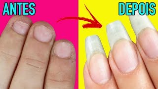 6 DICAS INCRÍVEIS PARA PARAR DE ROER AS UNHAS [upl. by Modestia655]