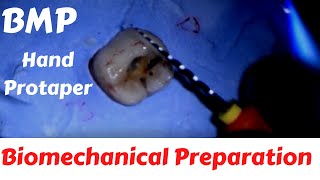 BMP Biomechanical Preparation Of Root Canal in Endodontics By Hand Protaper Step by Step Lecture [upl. by Anaik]