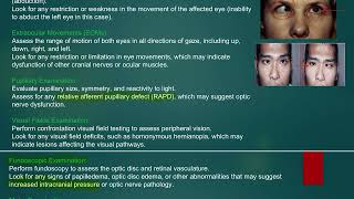 MRCP PACES NEUROLOGY STATION SIXTH NERVE PALSY [upl. by Lello]