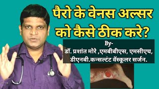 Foot Ulcer Treatment at home in Hindi Varicose Ulcer Treatment  Ulcer Treatment in Hindi [upl. by Nennahs466]