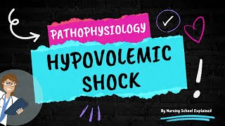 Pathophysiology of Hypovolemic Shock [upl. by Hctim]