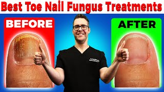 Best Toe Nail Fungus Treatments Onychomycosis Remedies [upl. by Meurer357]