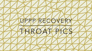 UPPP Patient Recovery Throat Pics [upl. by Anelaj136]