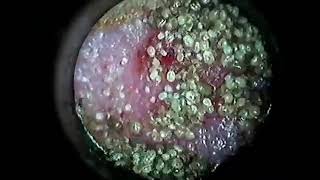 Ear Mites in a Rabbit  Veterinary Video [upl. by Novahc290]