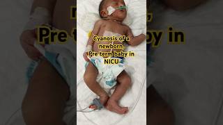 Cyanosis of a newborn  Pre term baby in NICU 🥹 cutebaby baby [upl. by Sutit]