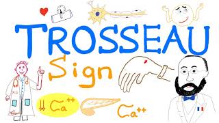 Trosseau Sign  Hypocalcemia  Carpal Spasm  Clinical Medicine [upl. by Woodward994]