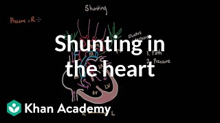 Shunting in the heart  Circulatory System and Disease  NCLEXRN  Khan Academy [upl. by Tallula481]