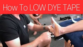 How To LOW DYE TAPE HEEL PAIN  Physio Mosman [upl. by Pratte]