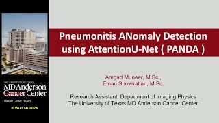 Technical Talk Predicting Immune Checkpoint Inhibitor Pneumonitis in Lung Cancer Patients Using [upl. by Rechaba]