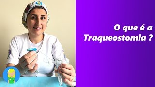 O Que é a Traqueostomia [upl. by Estis]