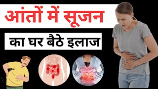 आंतो में सूजन Crohns disease  Causes Symptoms Diagnosis and Treatment crohnsdisease [upl. by Michella]