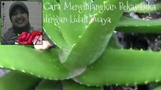 Cara Menghilangkan Bekas Luka Lama dengan Lidah Buaya Manfaat Lidah Buaya [upl. by Ahsaela]