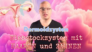 Eierstockzysten mit Haaren und Zähnen  Dermoidzysten [upl. by Ennovehc]