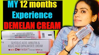 MY 12 MONTHS EXPERIENCE WITH DEMELAN CREAM  DEMELAN CREAM  DEMELAN  DEMELAN CREAM REVIEW  HEENA [upl. by Aerbua]